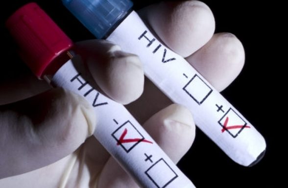 Teste HIV