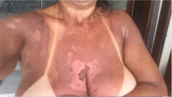 BRONZEAMENTO COM FITAS EM ITABUNA