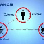 Leishmaniose