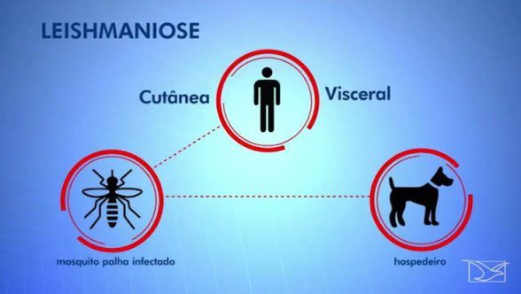 Leishmaniose