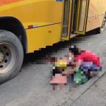 mulher perde a perna onibus