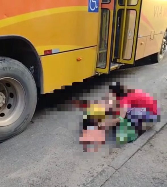 mulher perde a perna onibus